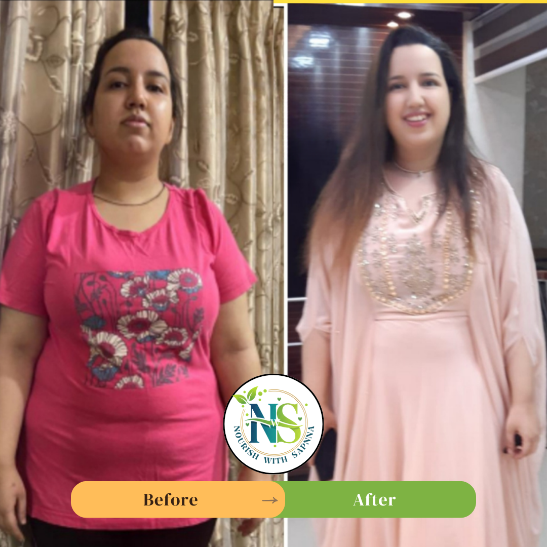 Female client before and after wellness transformation