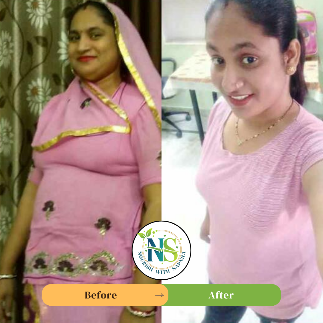 Female client before and after weight loss journey